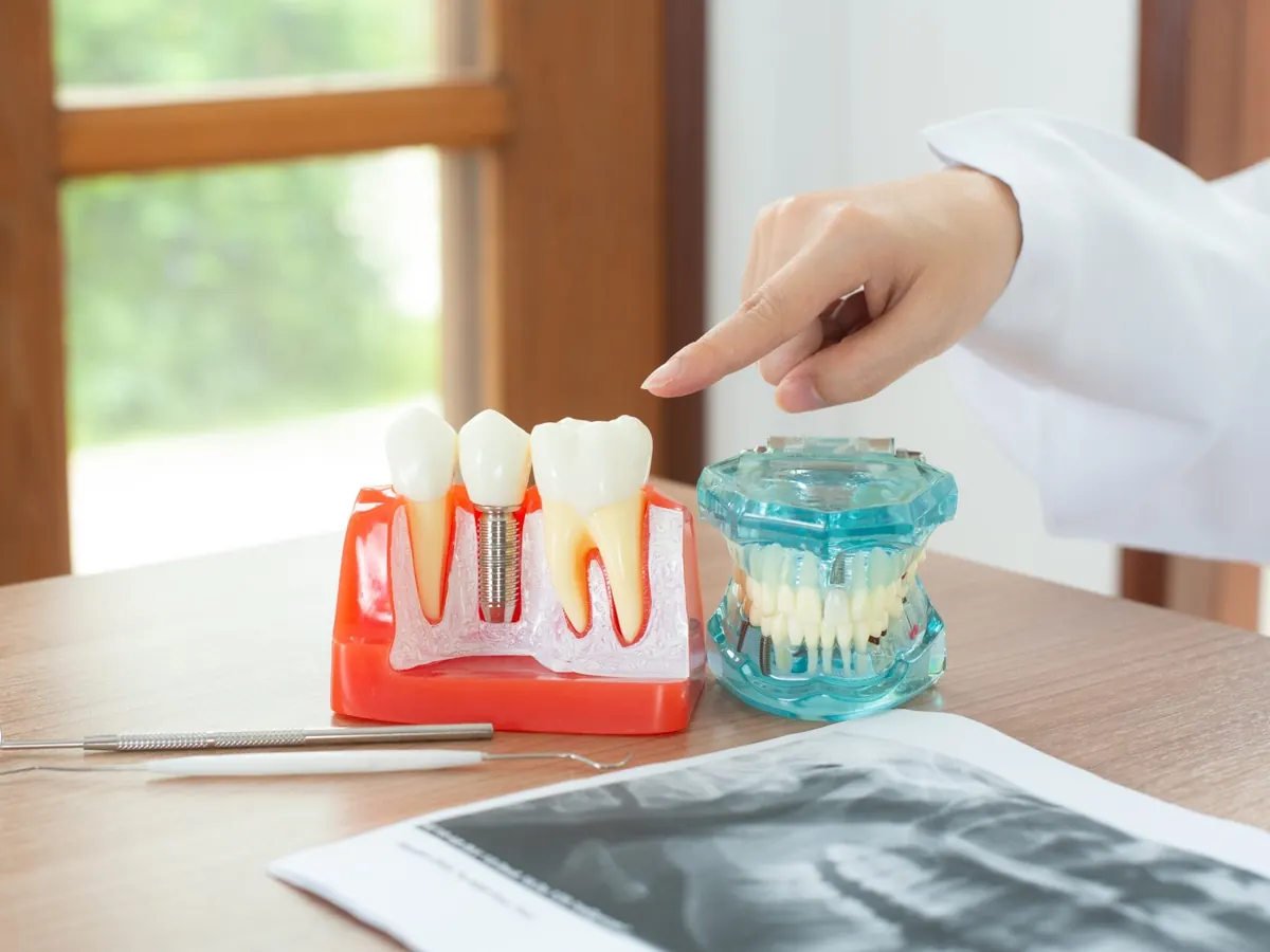 Medic care explica pe un model dentar cum se monteaza implantul